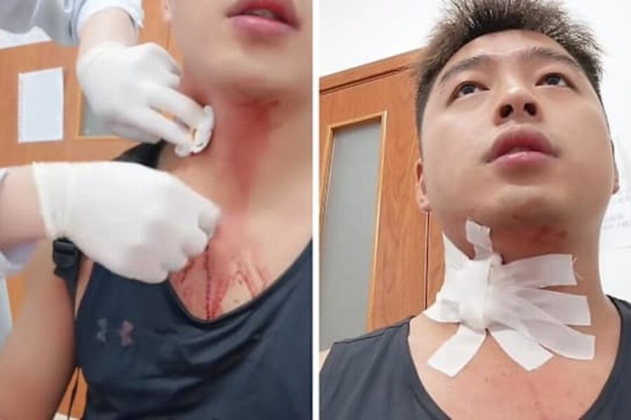 Người Đàn Ông Đã Gặp Nguy Hiểm Nghiêm Trọng Do Muỗi Đốt